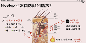 NiceTop所先养发胶囊双管齐下 从根源解决脱发难题